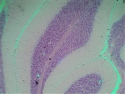 5 færdige prøver fra blod og indre organer 